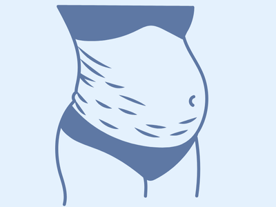 Best Cosmetic Gynaecology Treatment in South Mumbai